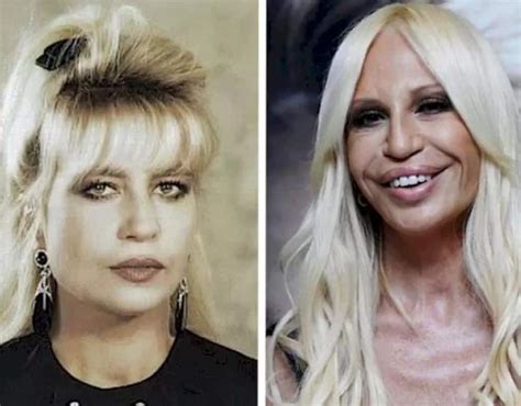 donatella versace ins|donatella versace face what happened.